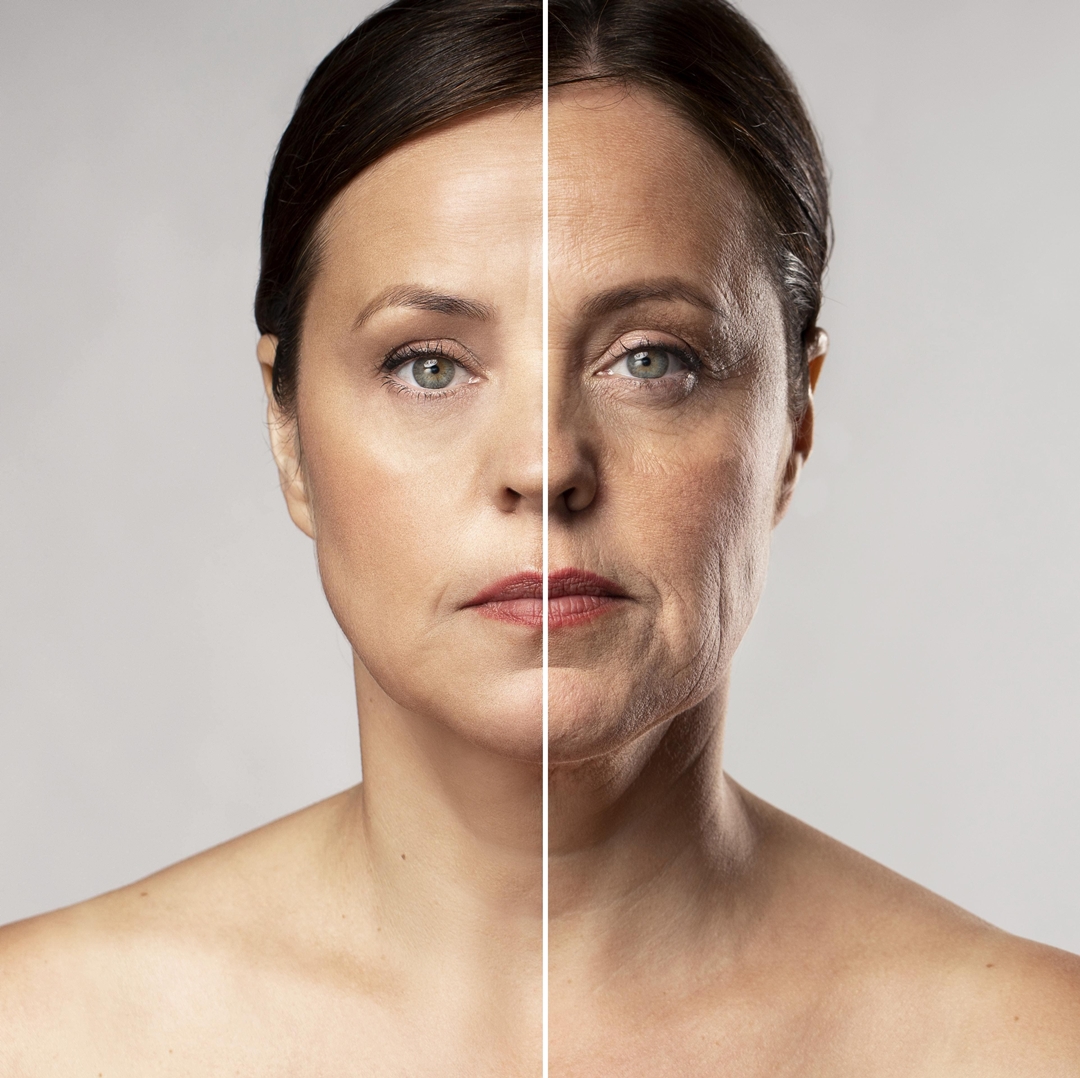 Rejuvenescimento Facial - Padma